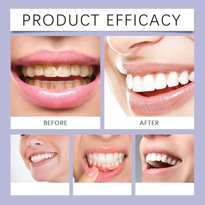 Microcrystalline Hydroxyapatite Powder,Microcrystalline Hydroxyapatite Powder for Teeth for Teeth Cleaning Stain Removal Dental (1)