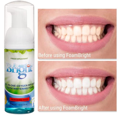 Retainer Cleaner & Aligner Cleaner FoamBright + Travel Retainer Case Kit | Great for Invisalign Aligners, Candid, Byte, Denture Cleaner | Whitens Teeth, Peroxide Free Oral Care | No Tablets Needed - color: 1 Unit + Travel Case