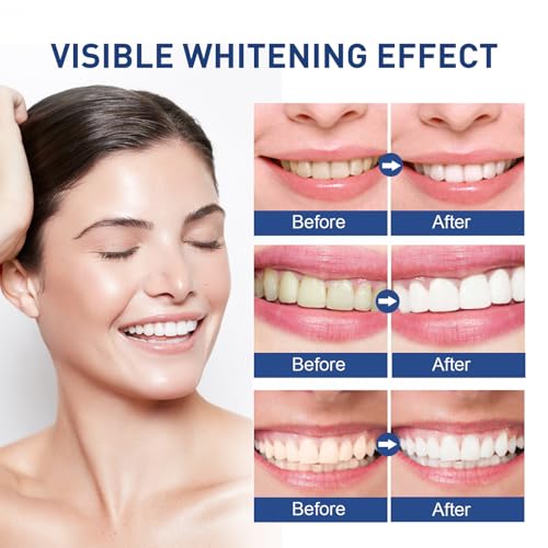 Microcrystalline Hydroxyapatite Powder,Microcrystalline Hydroxyapatite Powder for Teeth for Teeth Cleaning Stain Removal Dental (1)