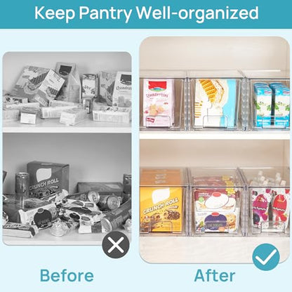 Vtopmart 2Pack Large Stackable Pantry Storage Drawers, Clear Organizer Bins with Handles, Acrylic Drawer Organizers for Kitchen, Pantry, Bathroom Undersink, Cabinet Organization and Storage - size: 2Pack 7"H
