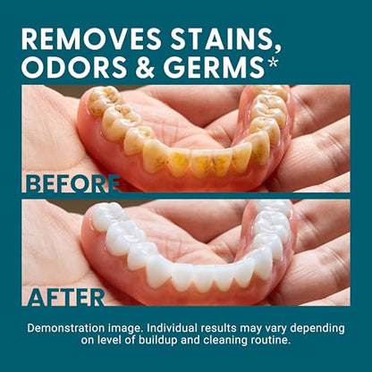Denture Bath Case and Retainer Case, Denture Bath Cup for Invisalign Retainers Mouthguards Dentures Cleaner Kit with Strainer Spill-Free Portable Retainer Cleaner Case by M3 Naturals (Pack of 2) - size: Bath Case (1 Count) (Pack of 2)